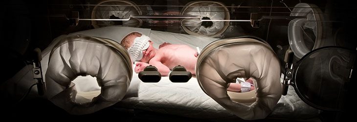 Preterm Birth and Prevention